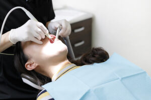 歯科医院で行うプロ(歯科衛生士)によるクリーニング