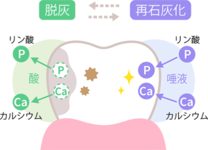 再石灰化