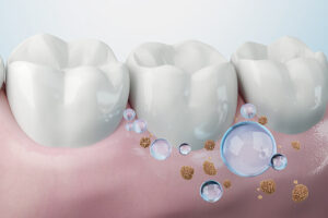 マウスウォッシュの効果